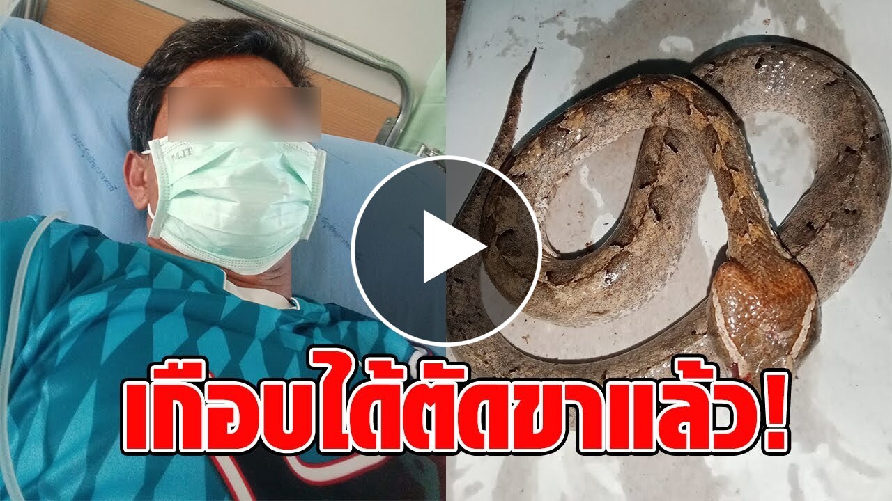 หนุ่มถูกงูกัด ไปหาหมอเอารูปให้ดู บอกเป็นงูไม่มีพิษ แต่ชาวเน็ตเห็นค้าน จึงรีบไปรพ.ในเมือง