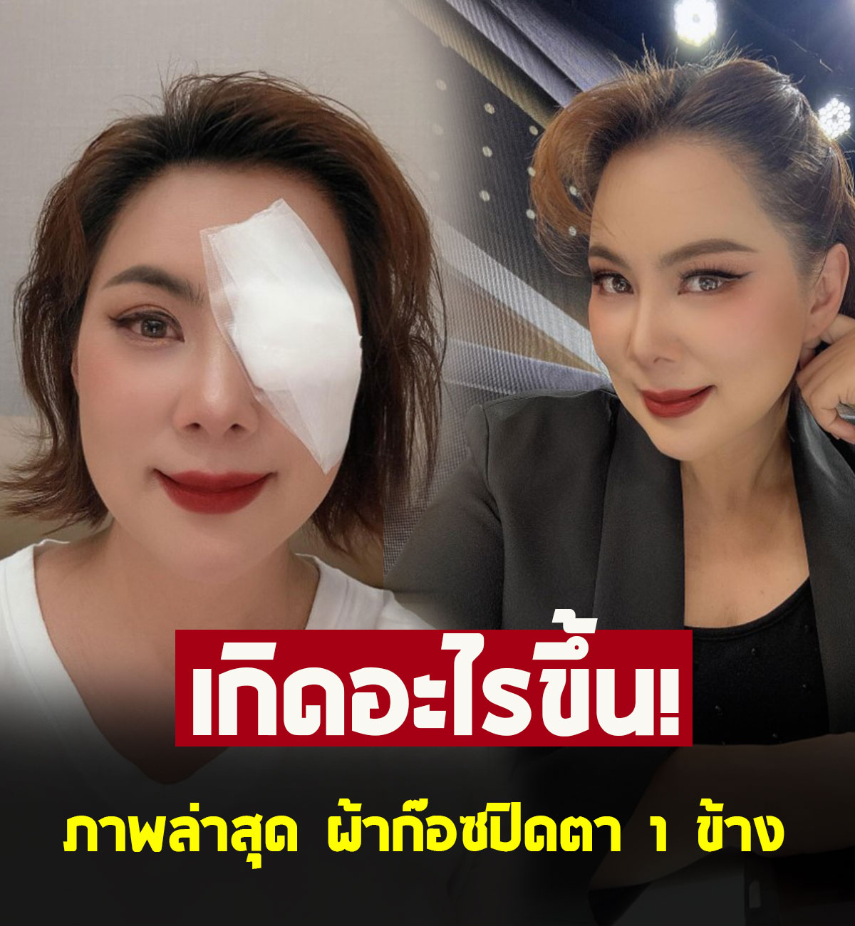 ภาพล่าสุด บุ๋ม ปนัดดา ผ้าก๊อซปิดตา 1 ข้าง แฟนๆ แห่เป็นห่วง
