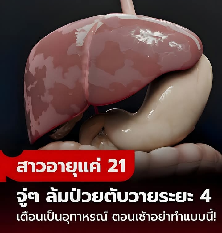 สาวอายุแค่ 21 ป่วยตับวายระยะ 4 เตือนเป็นอุทาหรณ์ “ตอนเช้า” อย่าทำแบบนี้!