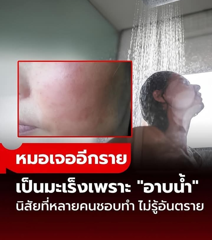 รู้ไว้ดีกว่า!! หมอเจออีกเคส “มะเร็งผิวหนัง” ต้นเหตุคือนิสัย “อาบน้ำ” แบบหลายคนชอบทำ