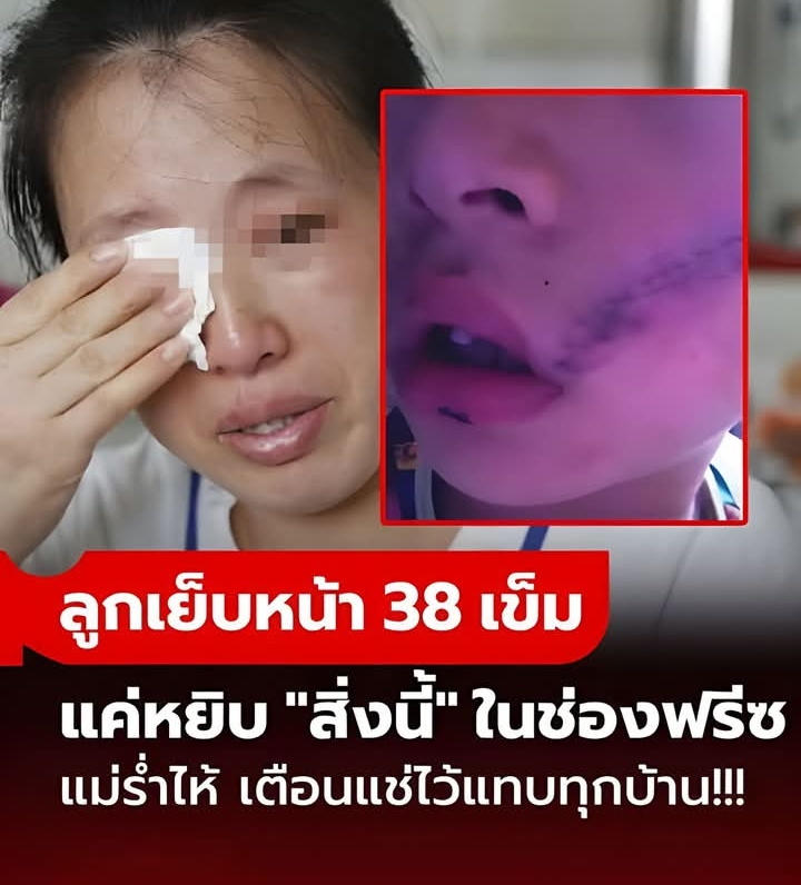 ลูกชายร้องลั่น เย็บหน้า 38 เข็ม แค่เพราะหยิบ “สิ่งนี้” จากช่องฟรีซ เตือนแช่ไว้แทบทุกบ้าน!!!
