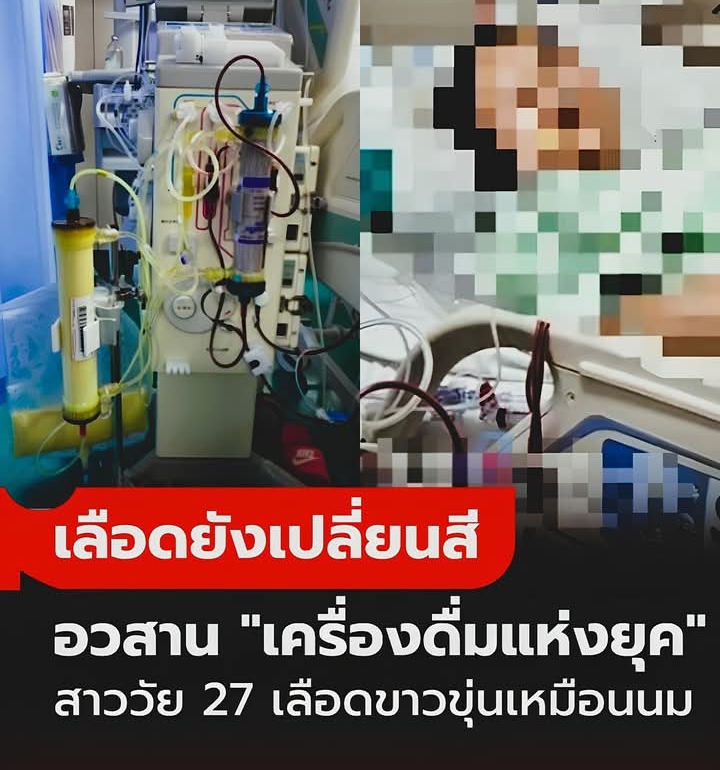 สาวอายุ 27 “เลือดเปลี่ยนสี” ขาวขุ่นเหมือนนม แพทย์ชี้สาเหตุช็อก เครื่องดื่มใกล้ตัวสุดๆ