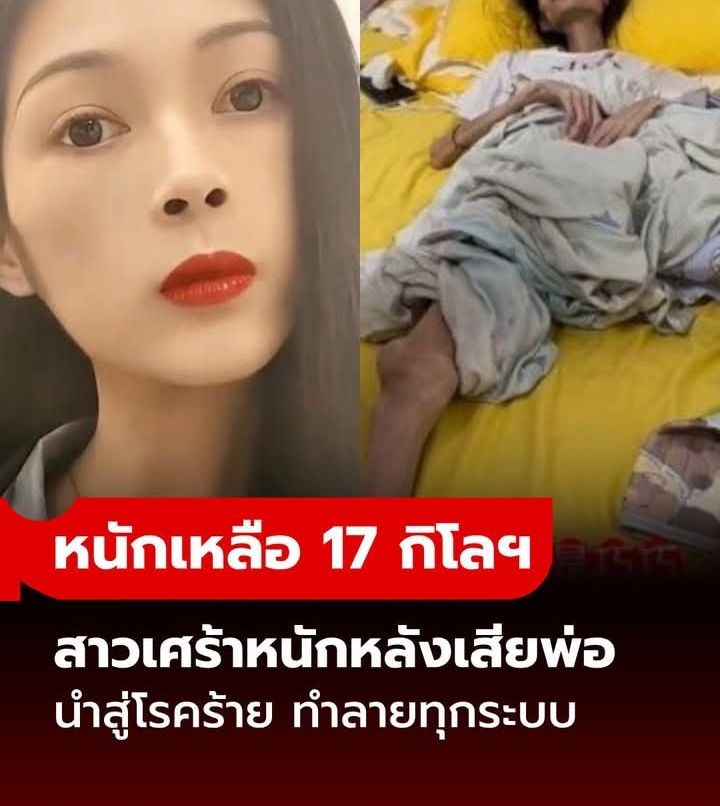สลด สาวเสียพ่อ ซึมเศร้าหนักนำสู่โรคร้าย น้ำหนักเหลือ 17 กิโลฯ เผยคำพูดก่อนจากไป สุดบีบหัวใจ